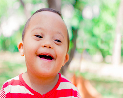 Tratamento de Síndrome de Down